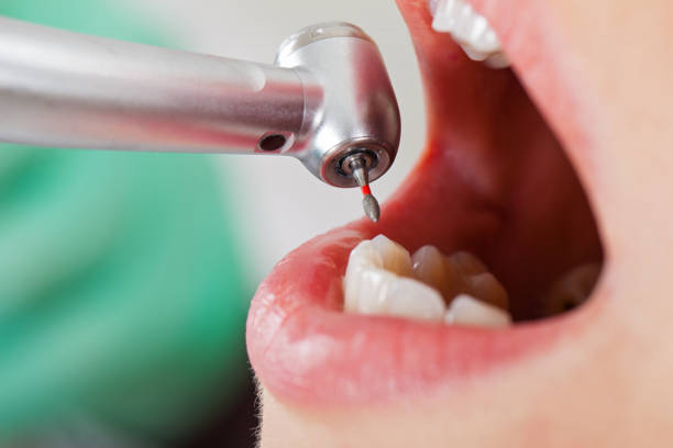 Best Urgent Dental Care for Toothaches in Eustace, TX